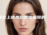 崇左上颌高位智齿拔除的价格多少呢