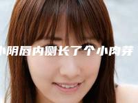 小阴唇内侧长了个小肉芽_小阴唇两侧不一样大小正常吗