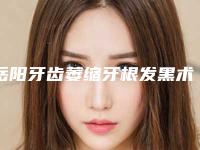 岳阳牙齿萎缩牙根发黑术的作用持续时间