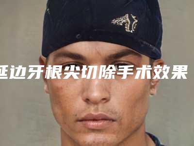 延边牙根尖切除手术效果如何价格贵吗