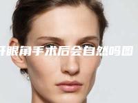 开眼角手术后会自然吗图片(开眼角会不自然吗)