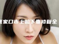 张家口市上睑下垂修复全新整形价格表爆出(2025年5月均价为:5775元)