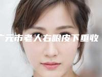 广元市老人右眼皮下垂收费标准项目均价展示(老人右眼皮下垂均价为:9187元)