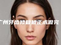 广州牙齿修复矫正术做完以后作用能保持多久