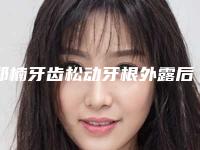 郑楠牙齿松动牙根外露后的护理和注意事项