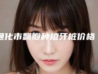 通化市翻瓣种植牙桩价格(费用)清单性价比公布-通化市翻瓣种植牙桩价格