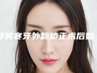 邹笑寒牙外翻矫正术后如何做肌肤保养