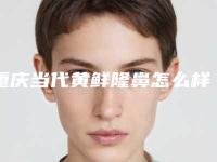 重庆当代黄鲜隆鼻怎么样