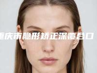 重庆市隐形矫正深覆合口腔医生上榜名单十强详情分析-刘国庆医生做手术名气很大哦