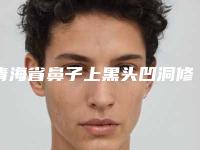青海省鼻子上黑头凹洞修复医院上榜清单名单收藏-青海省鼻子上黑头凹洞修复整形医院