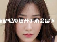 面部轮廓提升手术会留下后遗症吗如何避免