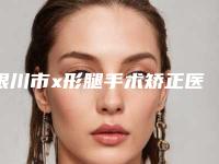 银川市x形腿手术矫正医院在榜清单必看-银川市姜洪涛医学美容诊所