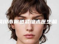 铜川市阴道紧缩术医生前十强排名榜超全榜单更新-铜川市谌煜整形医生