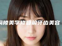 铜陵美学修复前牙齿美容有风险吗