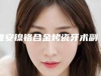 雅安镍铬合金烤瓷牙术副作用是什么呢