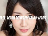 阻生齿智齿微创拔除术前准备及术后护理