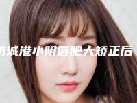 防城港小阴唇肥大矫正后有没有什么风险