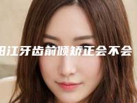 阳江牙齿前倾矫正会不会对面部表情产生影响