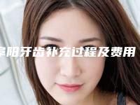 阜阳牙齿补充过程及费用-阜阳牙齿补充手术价格一览表