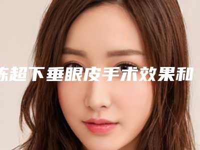 陈超下垂眼皮手术效果和哪些因素有关