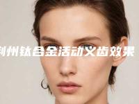 荆州钛合金活动义齿效果是怎么样的