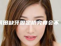 莆田缺牙固定桥究竟会不会有副作用发生