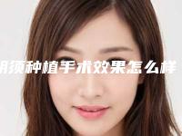胡须种植手术效果怎么样