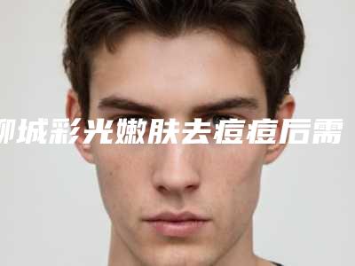聊城彩光嫩肤去痘痘后需如何护理