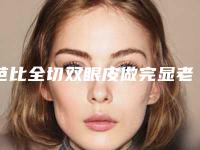 芭比全切双眼皮做完显老怎么办 让你重塑年轻姿态
