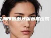 芜湖市侧面牙龈萎缩医院上榜清单前十名近期全新公布(芜湖市侧面牙龈萎缩口腔医院领头前三甲)