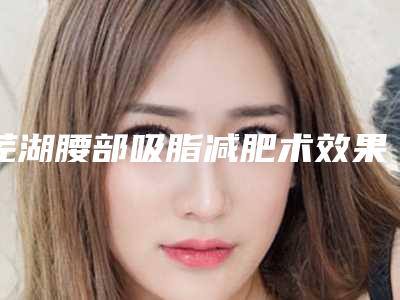 芜湖腰部吸脂减肥术效果好多少钱