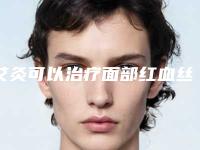 艾灸可以治疗面部红血丝吗