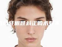 营口牙根倾斜正畸术好不好,可以保持多久