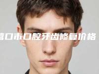 营口市口腔牙齿修复价格(价目)表全新火热上线-营口市口腔牙齿修复价格