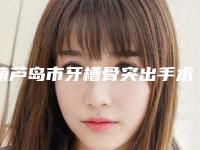 葫芦岛市牙槽骨突出手术上榜清单前十权威筛选实力封神-葫芦岛市牙槽骨突出手术口腔医生
