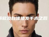 蒋欣凌自体植发手术之后如何护理才能快速恢复自然