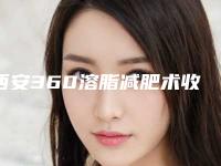 西安360溶脂减肥术收多少钱「西安360溶脂减肥的费用便宜吗」