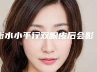 衡水小平行双眼皮后会影响以后走路吗