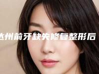 达州前牙缺失修复整形后多久会出现后遗症