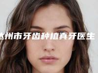 达州市牙齿种植真牙医生上榜清单公开-达州市杨志荣口腔医生