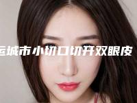 运城市小切口切开双眼皮医院上榜名单前十强2025榜单新出炉(运城市小切口切开双眼皮整形医院)