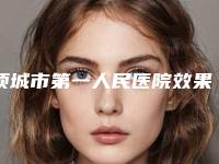 项城市第一人民医院效果哪个好-价目表手术曝光
