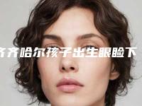 齐齐哈尔孩子出生眼睑下垂为什么有后遗症你知道吗