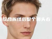 鼻综合拆线后整个鼻头右偏怎么办,鼻综合拆线后鼻头很大