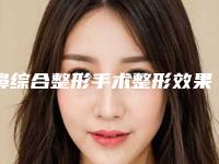 鼻综合整形手术整形效果如何