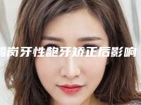 鹤岗牙性龅牙矫正后影响怀孕吗
